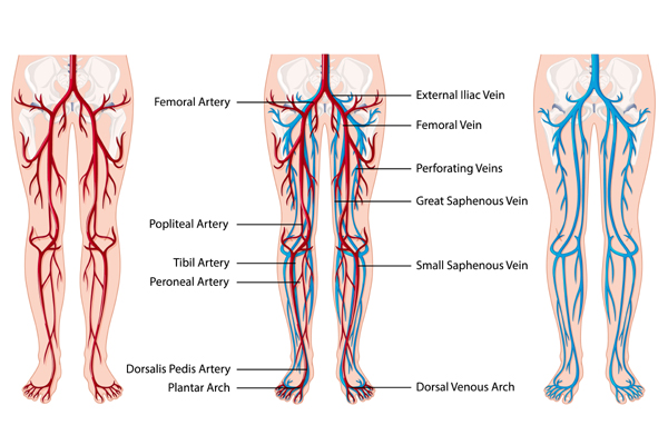 Peripheral Vascular Surgery